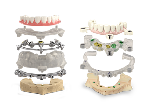 Surgical Full-arch Solutions