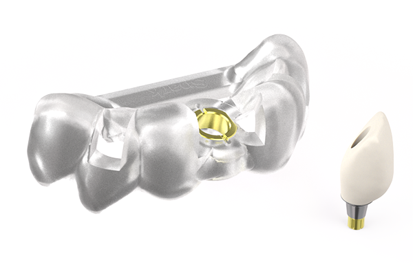 Single-unit Guide and Abutment